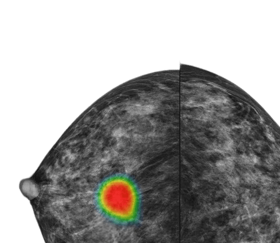 Seamless AI Support for 3D Mammography Interpretation