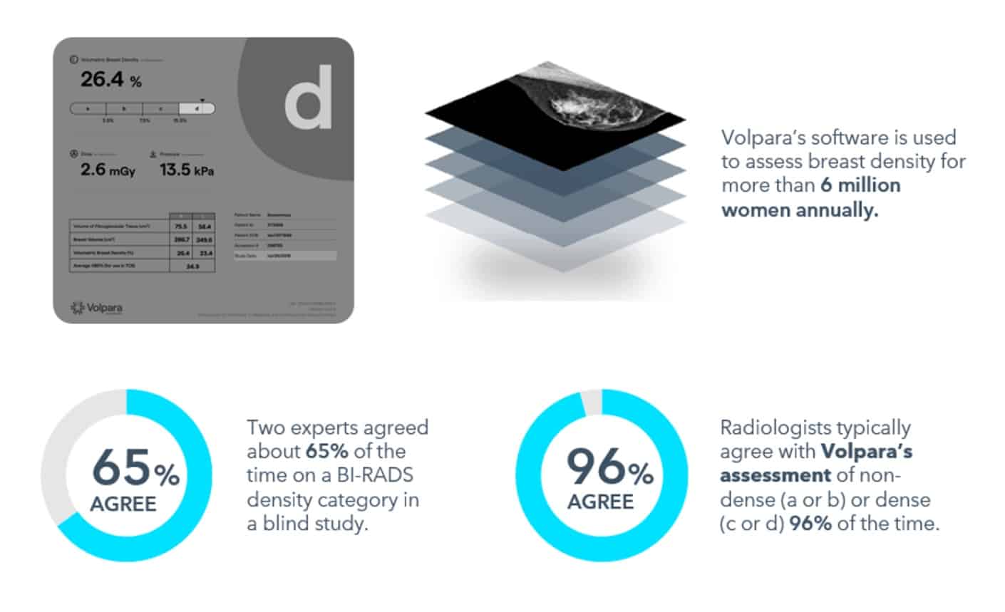 Circular chart showing 96% agreement between radiologists and breast density assessment software on dense vs non-dense classifications.