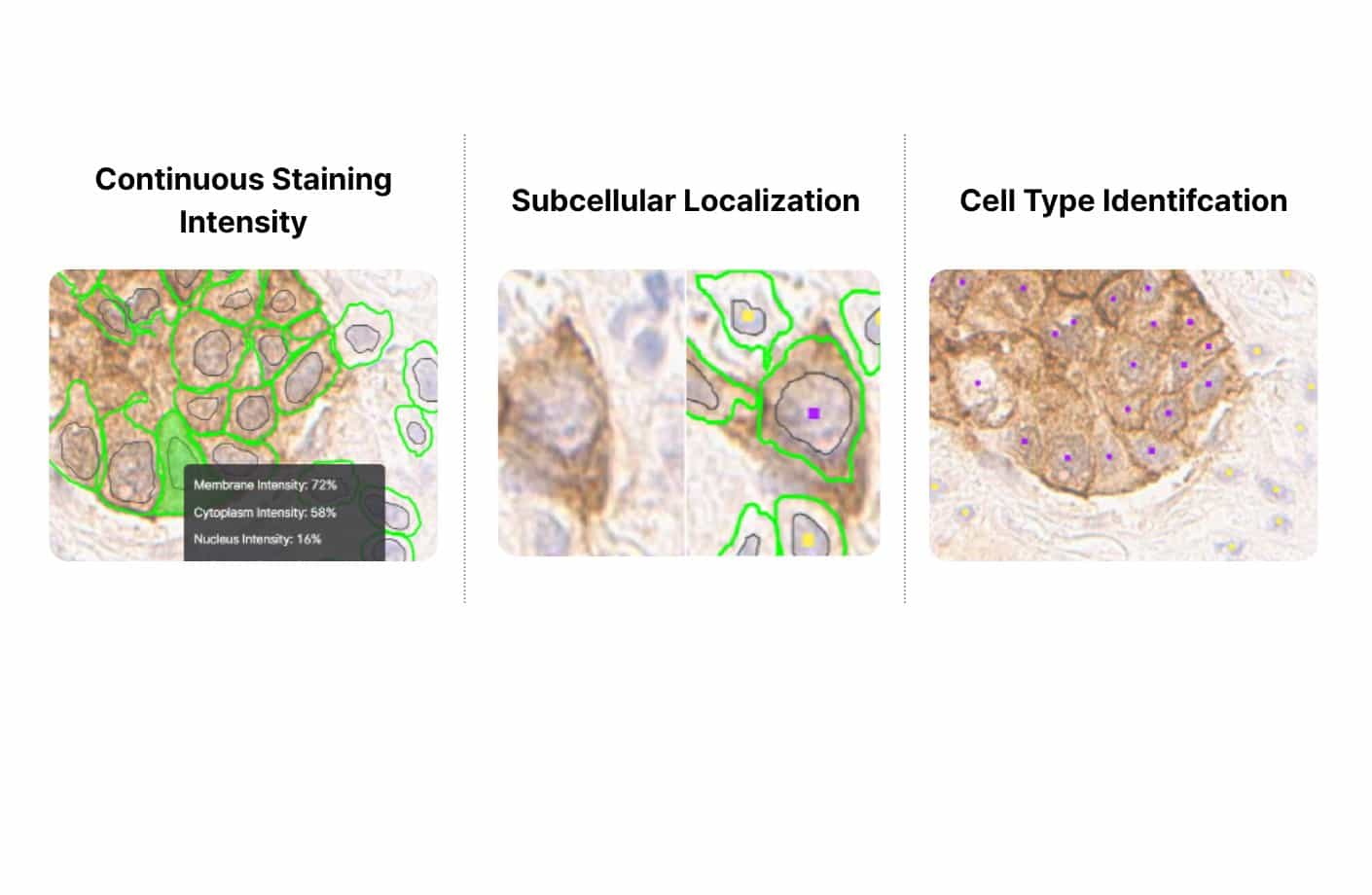 Microscopic tissue images showing AI quantification of staining intensity, subcellular localization, and cell type identification for IHC analysis.