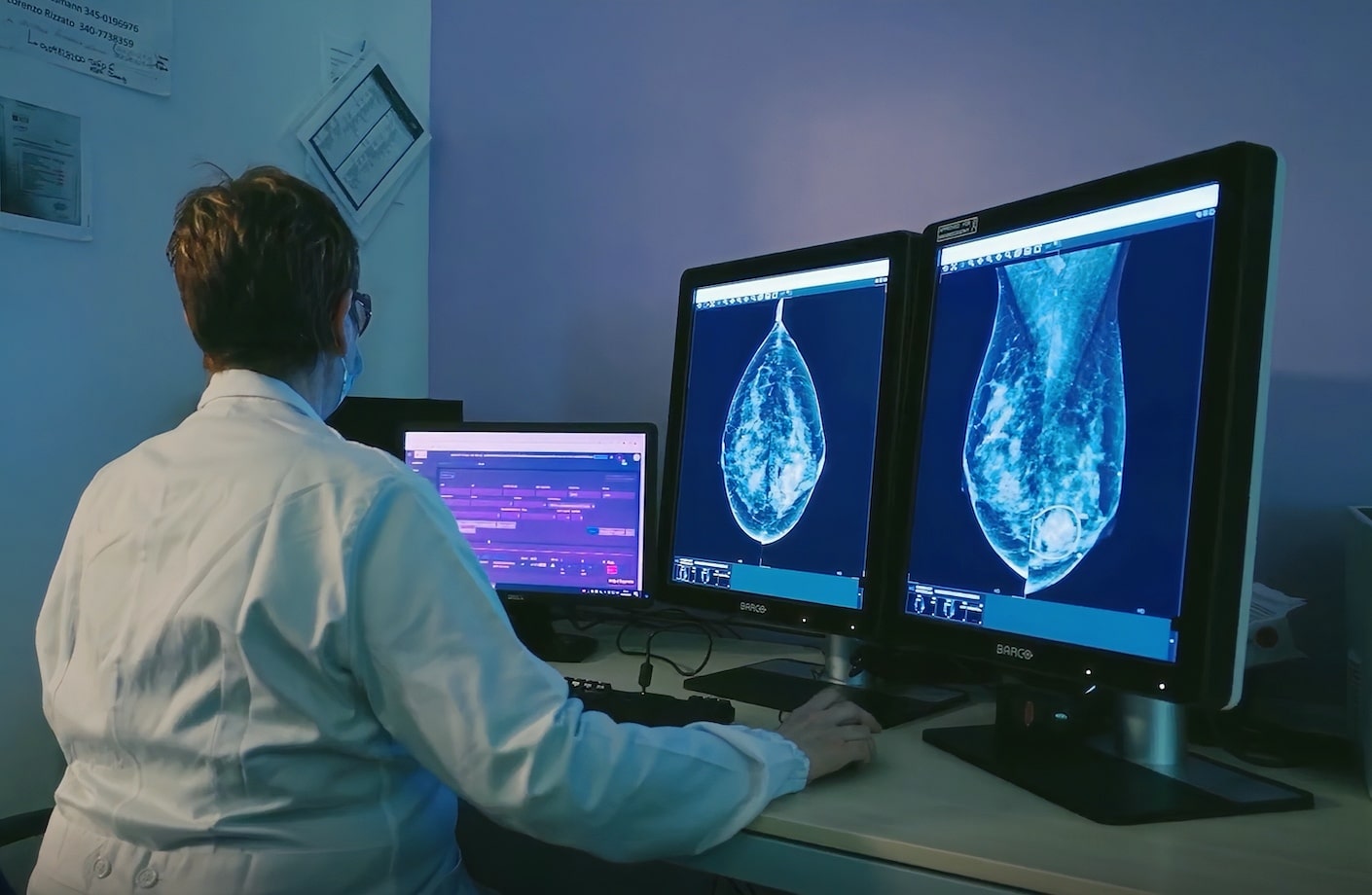 Radiologist using AI radiology software to analyze mammogram images.