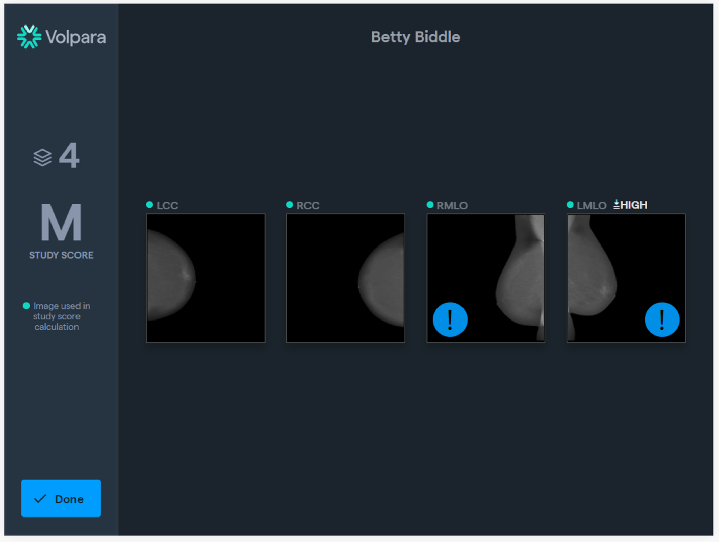 Mammography software dashboard displaying image quality indicators across multiple breast views to ensure consistent imaging outcomes system-wide.