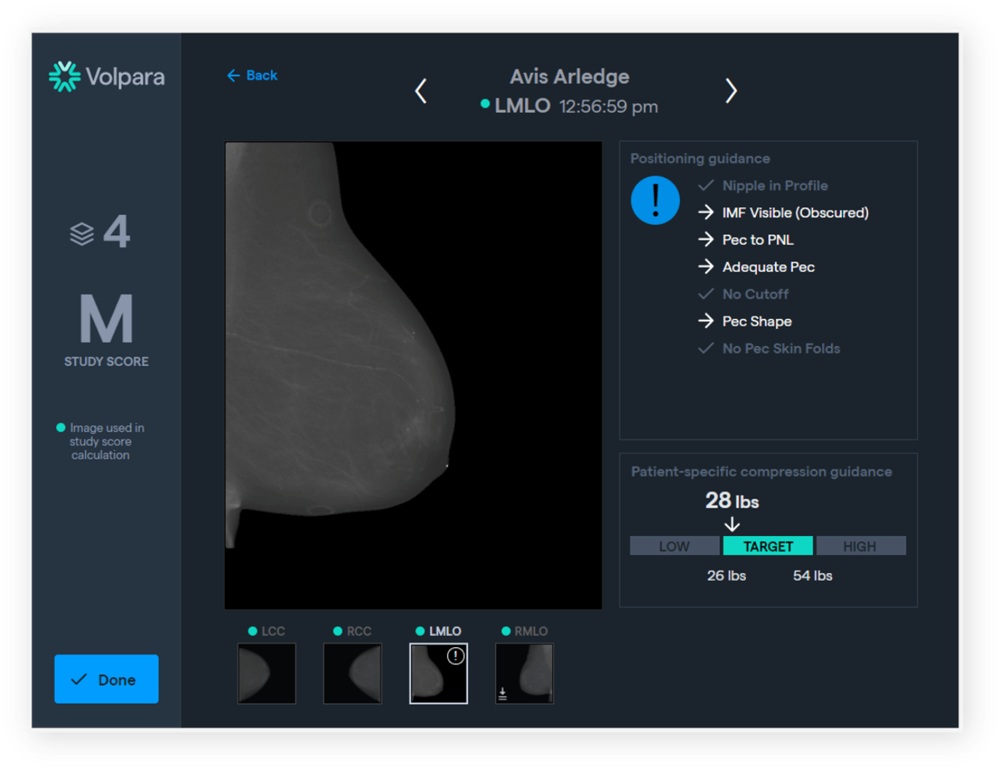 Screenshot of mammography software interface showing real-time image quality feedback on positioning and compression for continuous technologist skill improvement.