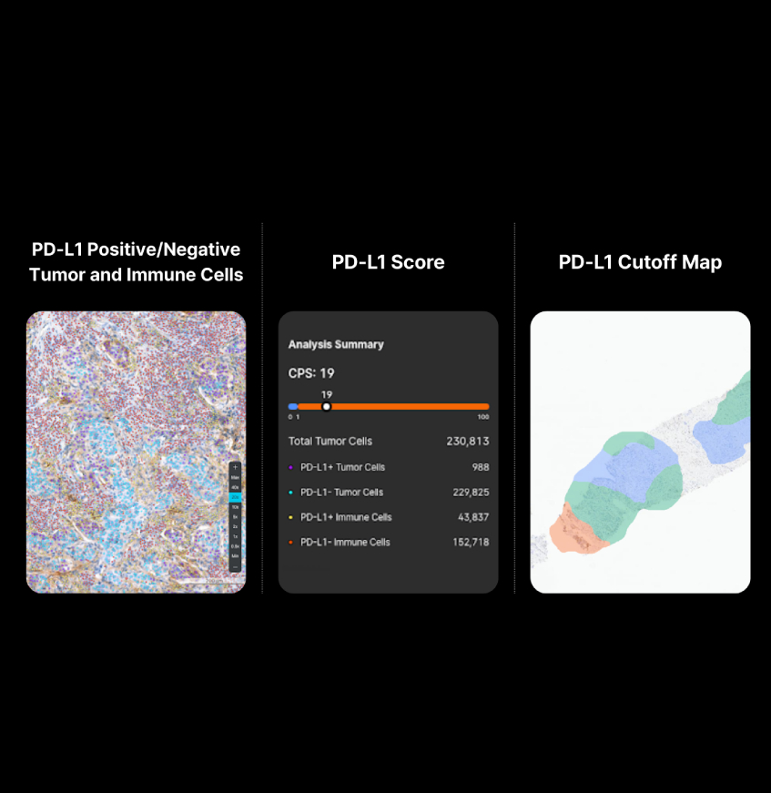 AI-Powered Detection and Classification of PD-L1 Expression