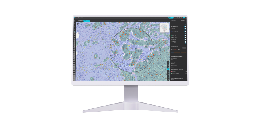 Lunit SCOPE IO Immuno-Oncology