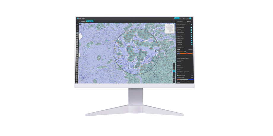 루닛 스코프 IO 면역 항암 연구