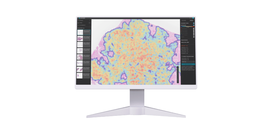 루닛 스코프 GP종양 특성 예측