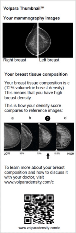 FDA Breast Density Reporting Rule is a Critical Step for Women says ...