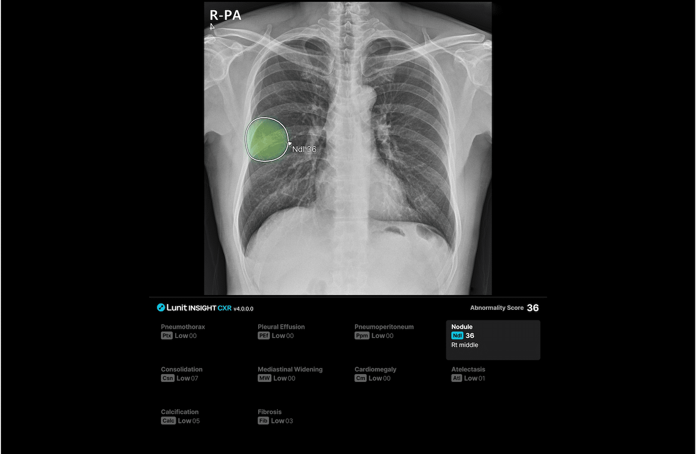 이상 부위 값 표기 및 리포트 제공