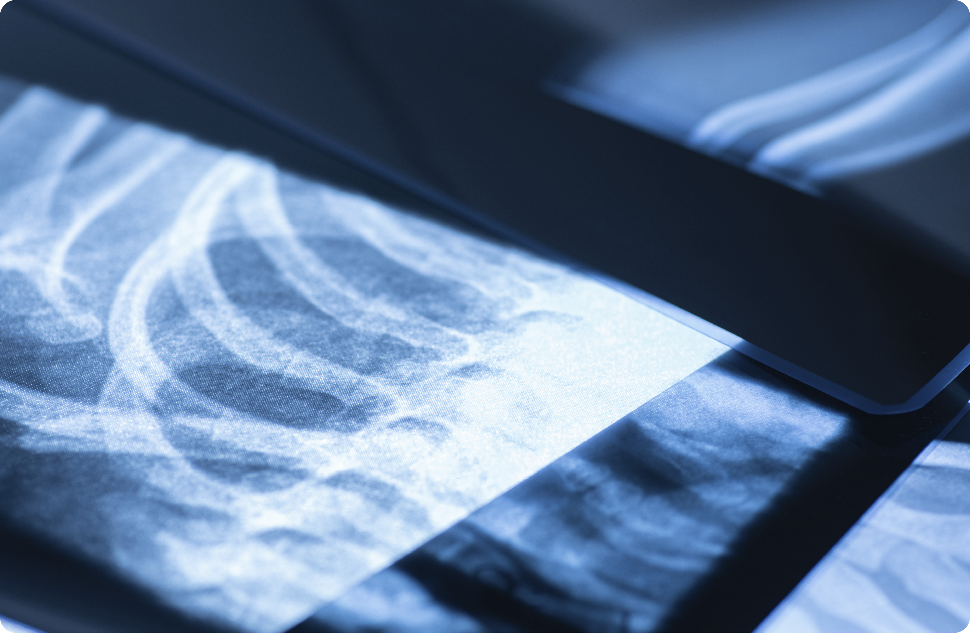루닛 인사이트 CXR4에 대해 더 알아보고 싶으신가요?