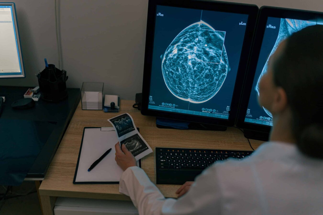 Give Patients More Choice and Boost Your Bottom Line with SecondRead™ AI