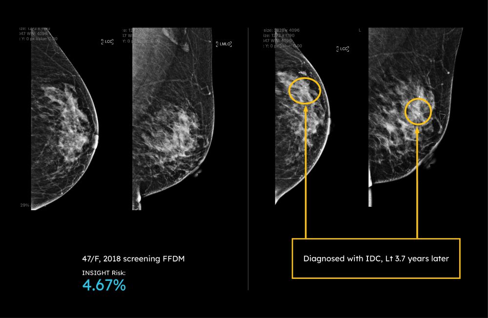 A risk signal clinicians can be confident in.